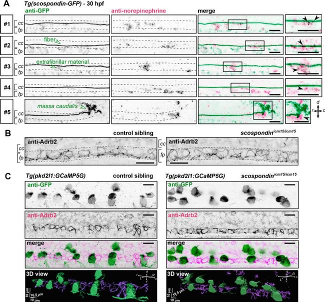 beta-2 Adrenergic Receptor Antibody in Immunohistochemistry (IHC)