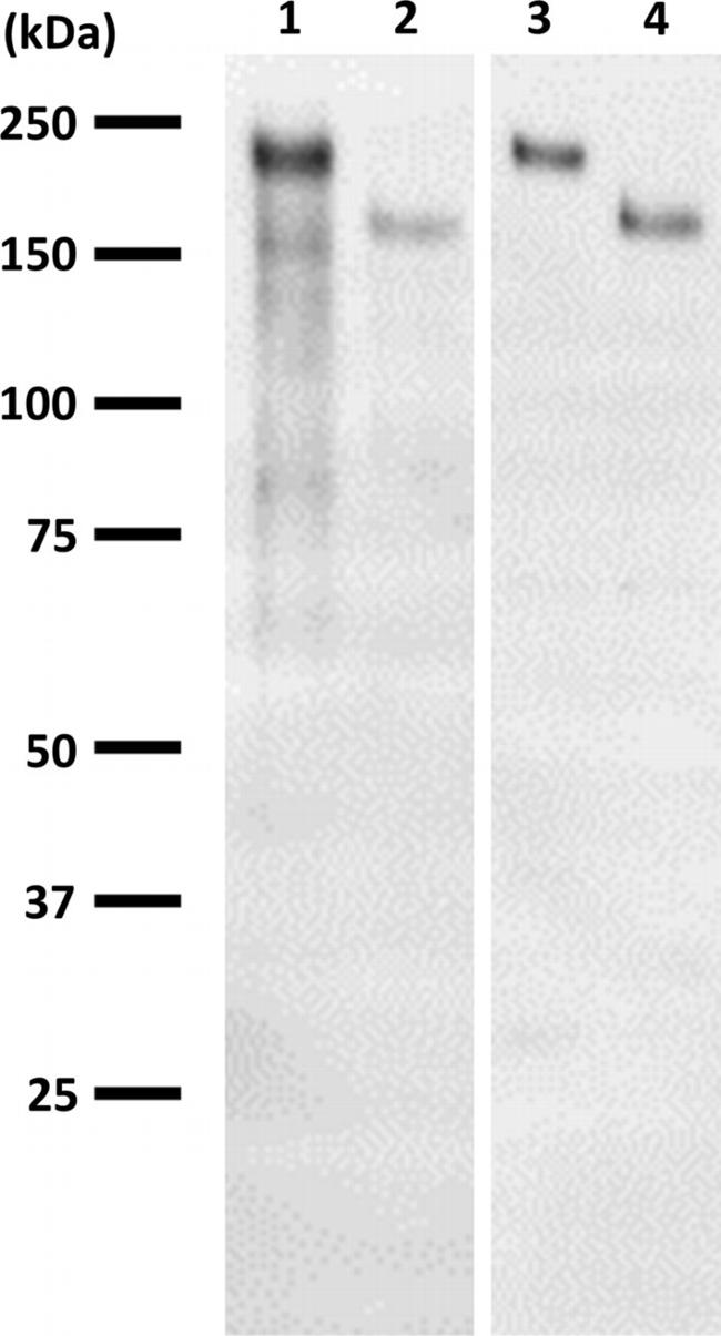 Ataxin 2 Antibody in Western Blot (WB)