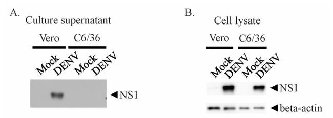 Dengue Virus Type 2 NS1 Antibody in Western Blot (WB)