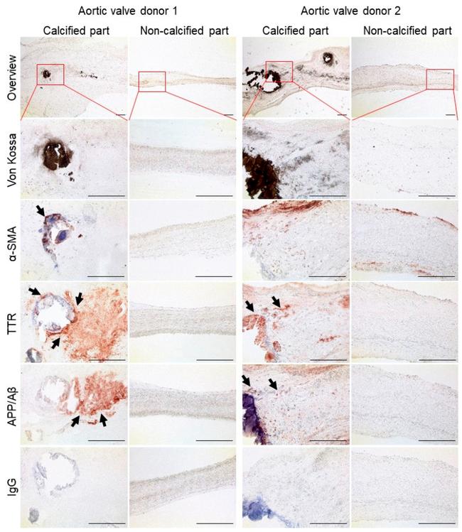 Transthyretin Antibody in Immunohistochemistry (IHC)