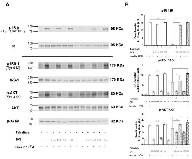 Phospho-IRS1 (Tyr612) Antibody in Western Blot (WB)