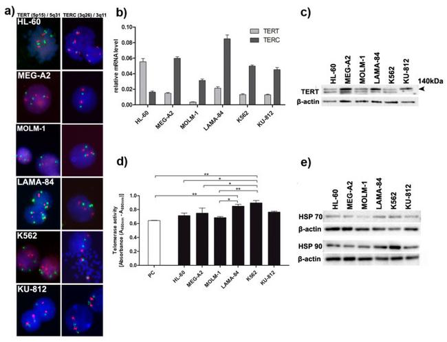 HSP90 beta Antibody in Western Blot (WB)