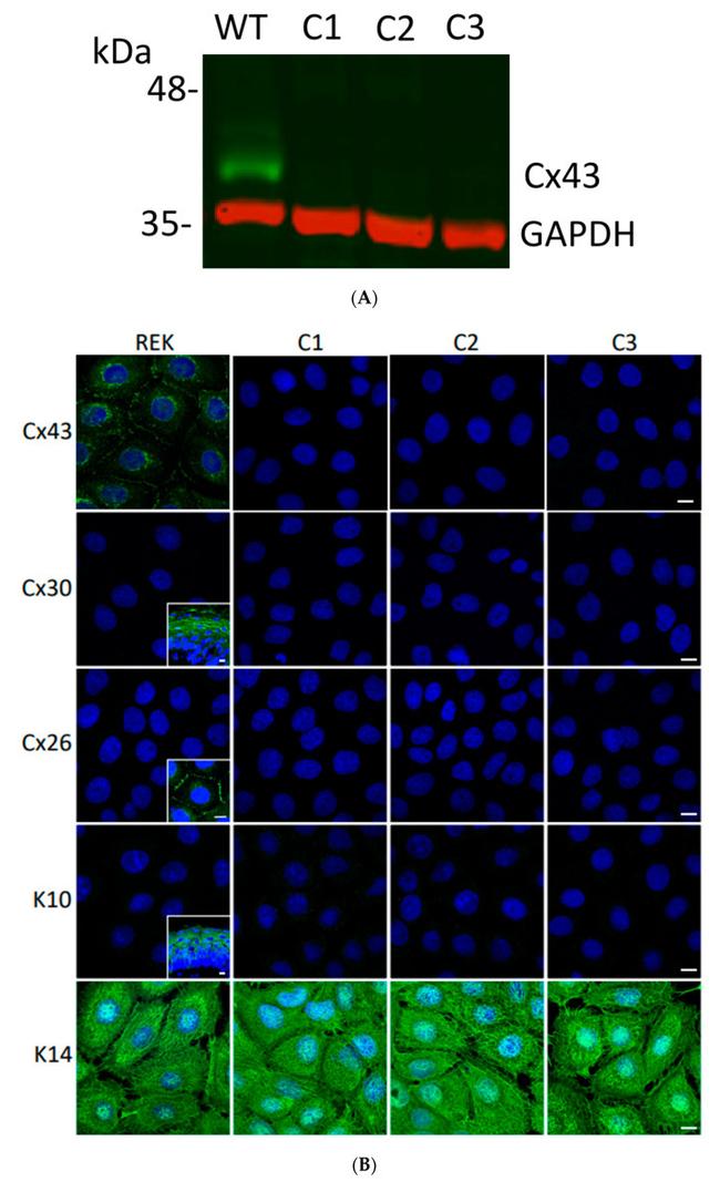 Connexin 26 Antibody in Immunocytochemistry (ICC/IF)