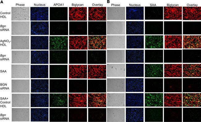 Biglycan Antibody in Immunocytochemistry, Immunohistochemistry (ICC/IF, IHC)