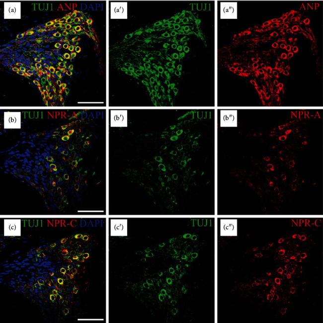 NPR3 Antibody in Immunohistochemistry (IHC)