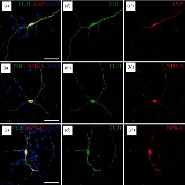 NPR3 Antibody in Immunohistochemistry (IHC)