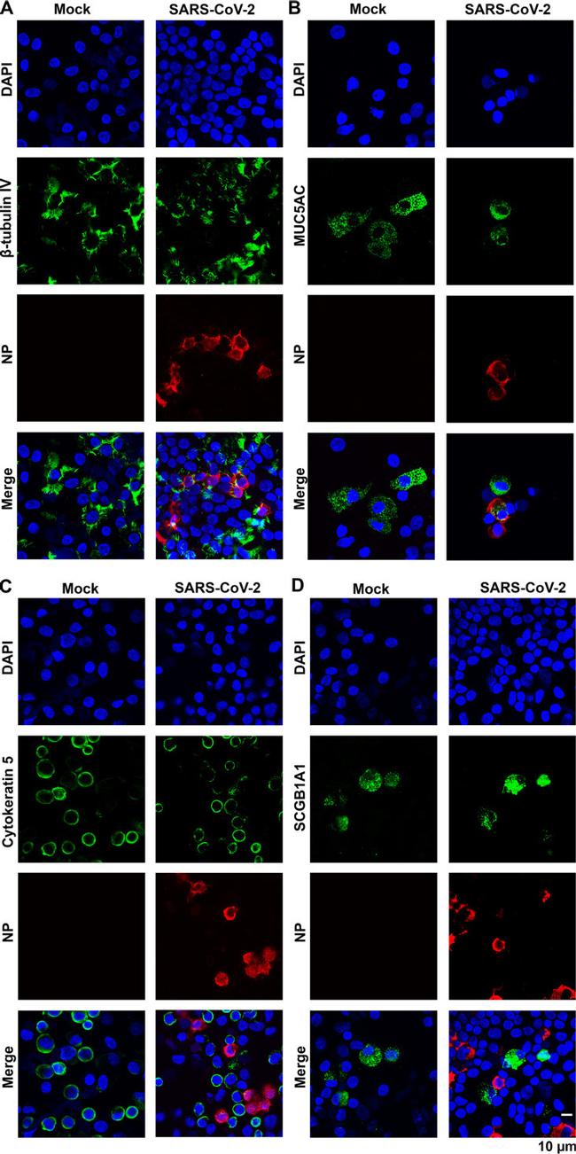 Cytokeratin 5 Antibody in Immunocytochemistry (ICC/IF)