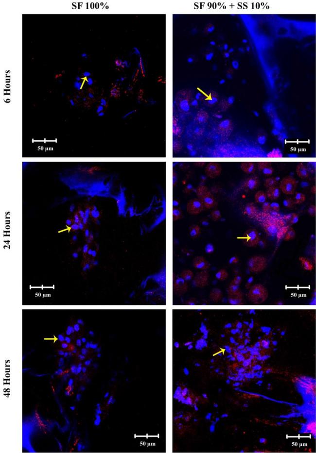 ITGB1 Antibody in Immunocytochemistry (ICC/IF)