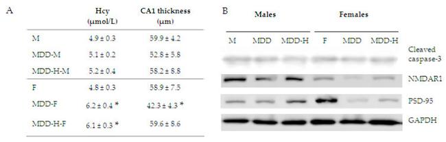 NMDAR1 Antibody in Western Blot (WB)