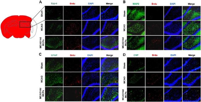 BrdU Antibody in Immunohistochemistry (IHC)