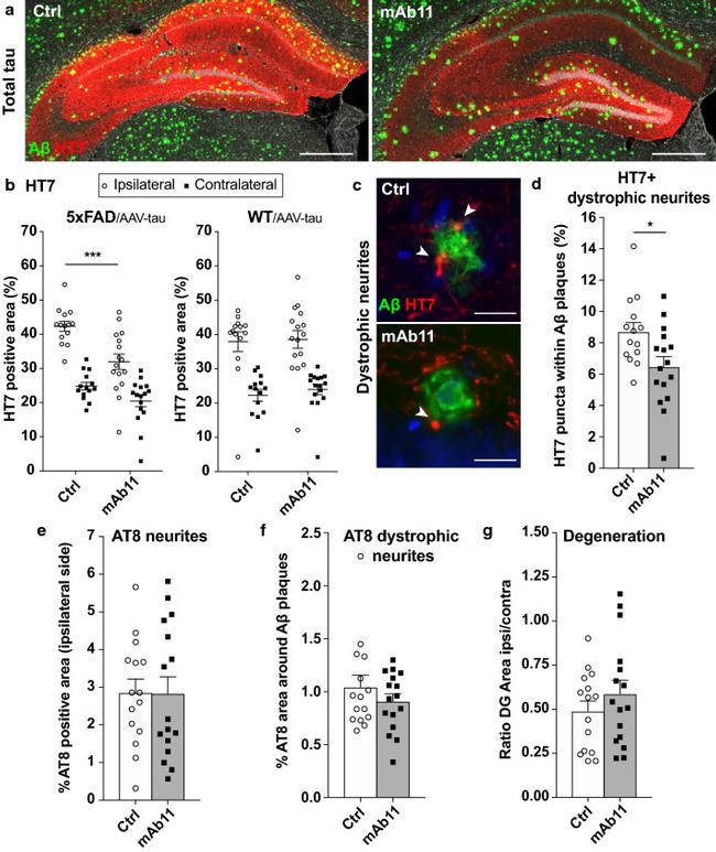 Tau Antibody in Immunohistochemistry (IHC)