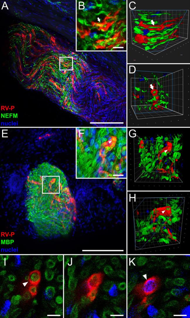 MBP Antibody in Immunocytochemistry (ICC/IF)