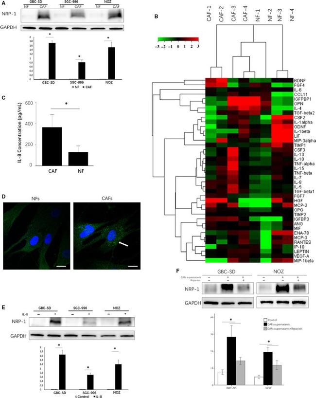 IL-8 (CXCL8) Antibody in Immunocytochemistry (ICC/IF)