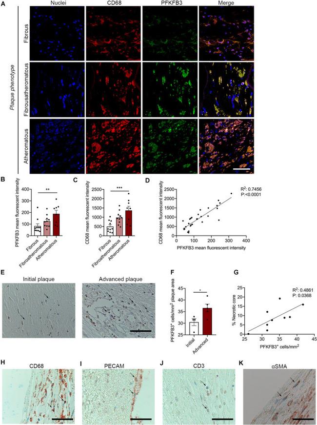 CD68 Antibody in Immunohistochemistry (IHC)