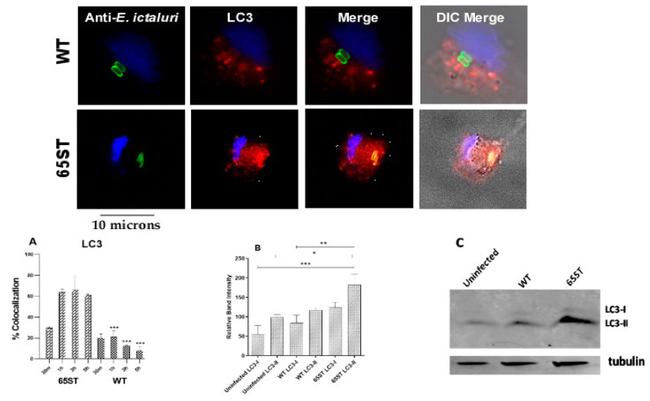 LC3A/LC3B Antibody in Immunocytochemistry (ICC/IF)