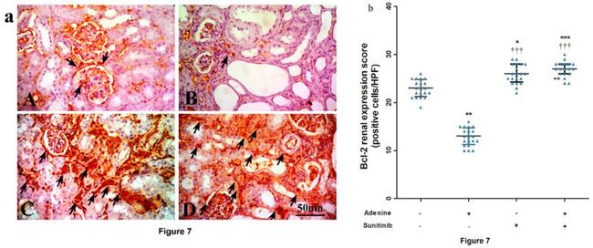 Bcl-2 Antibody in Immunohistochemistry (IHC)