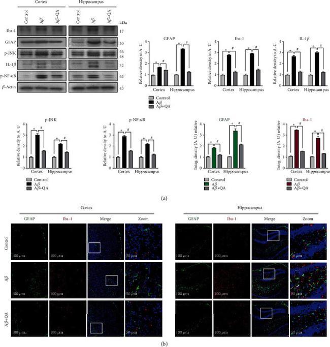 IBA1 Antibody in Immunohistochemistry (IHC)