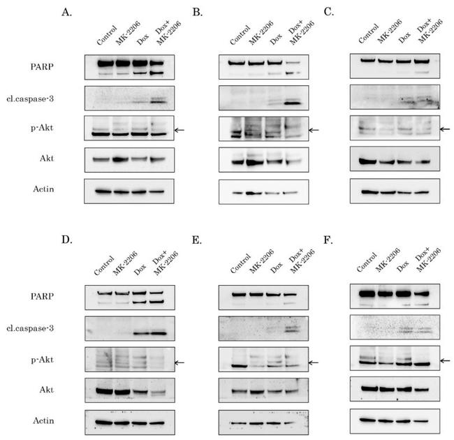 PARP1 Antibody in Western Blot (WB)