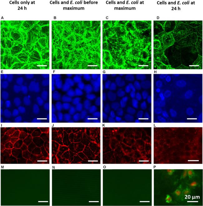 ZO-1 Antibody in Immunocytochemistry (ICC/IF)