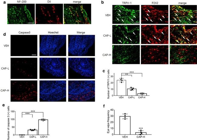 P2X2 Antibody in Immunohistochemistry (IHC)