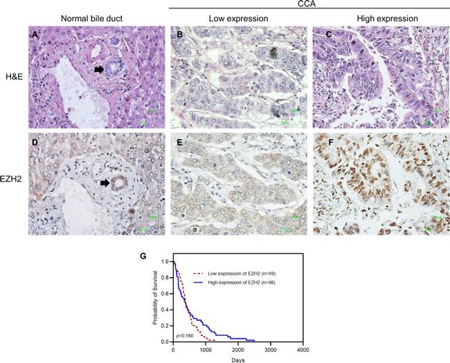 EZH2 Antibody in Immunohistochemistry (IHC)