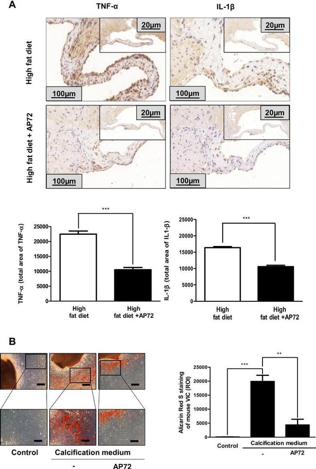 TNF alpha Antibody in Immunohistochemistry (IHC)