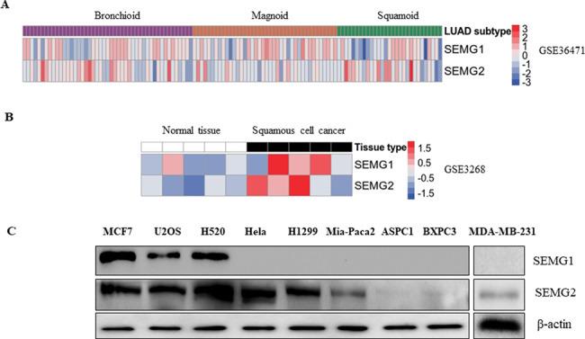 SEMG2 Antibody in Western Blot (WB)