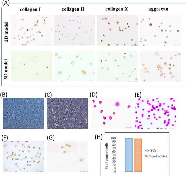 Aggrecan Antibody in Immunocytochemistry (ICC/IF)