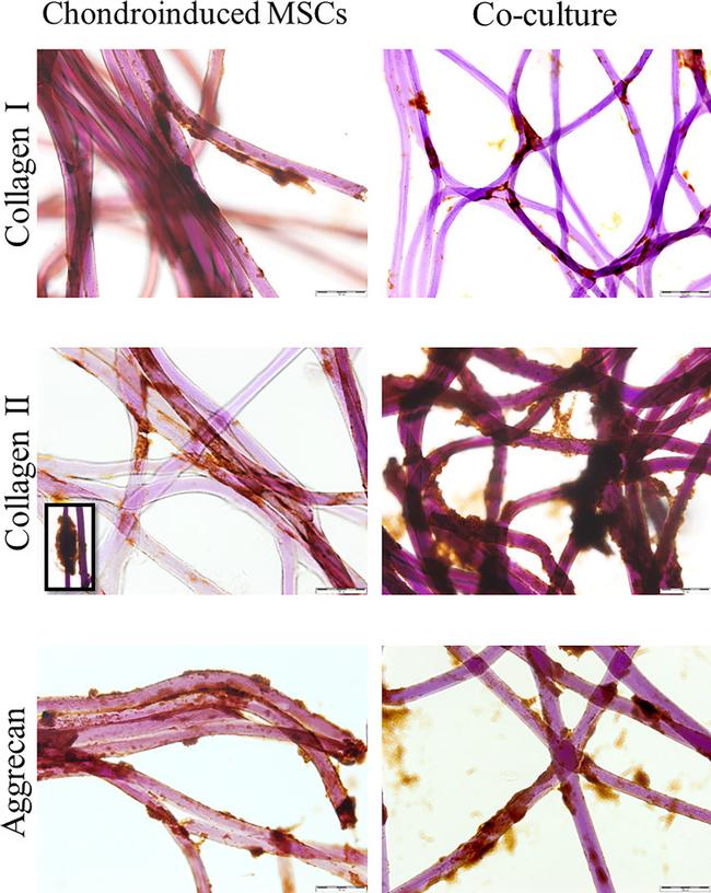 Aggrecan Antibody in Immunocytochemistry (ICC/IF)