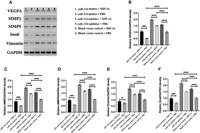 VEGF Antibody in Western Blot (WB)