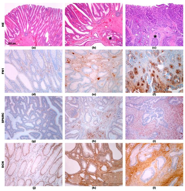 SPARC Antibody in Immunohistochemistry (IHC)