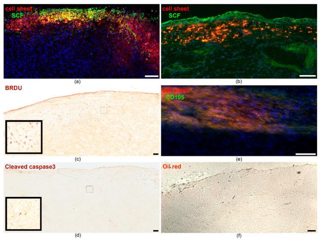 SCF Antibody in Immunohistochemistry (IHC)