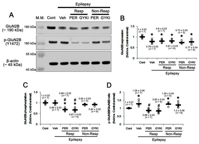 NMDAR2B Antibody in Western Blot (WB)