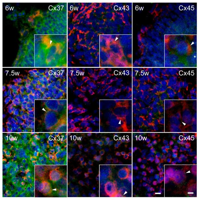 PGP9.5 Antibody in Immunohistochemistry (IHC)