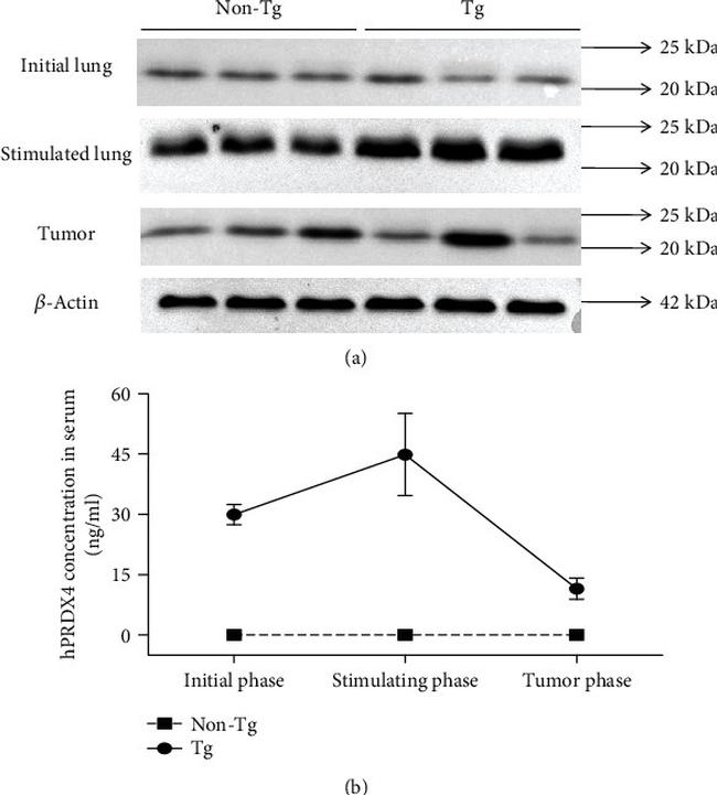 PRDX4 Antibody in Western Blot (WB)