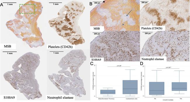 S100A9 Antibody in Immunohistochemistry (IHC)