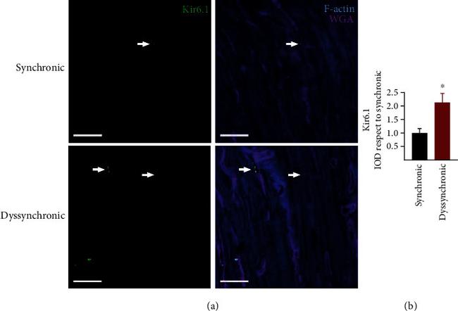 Kir6.1 (KCNJ8) Antibody in Immunohistochemistry (IHC)