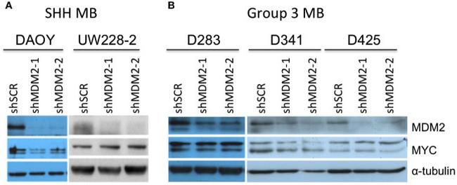 MDM2 Antibody in Western Blot (WB)