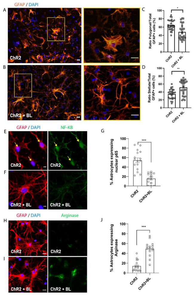 GFAP Antibody in Immunocytochemistry (ICC/IF)