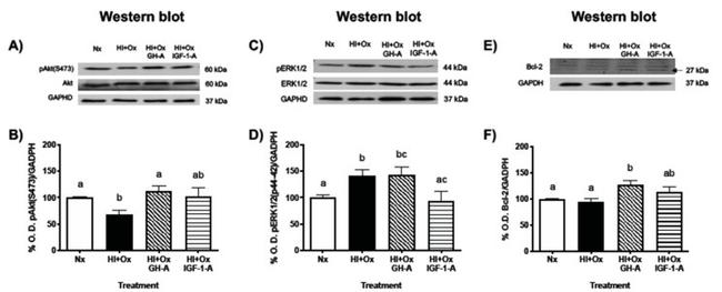 Bcl-2 Antibody in Western Blot (WB)