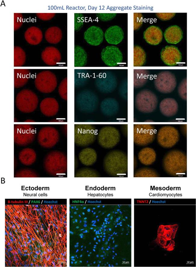 Cardiac Troponin T Antibody in Immunocytochemistry (ICC/IF)