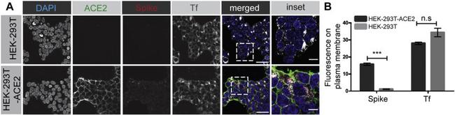 6x-His Tag Antibody in Immunocytochemistry (ICC/IF)