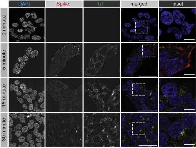 6x-His Tag Antibody in Immunocytochemistry (ICC/IF)