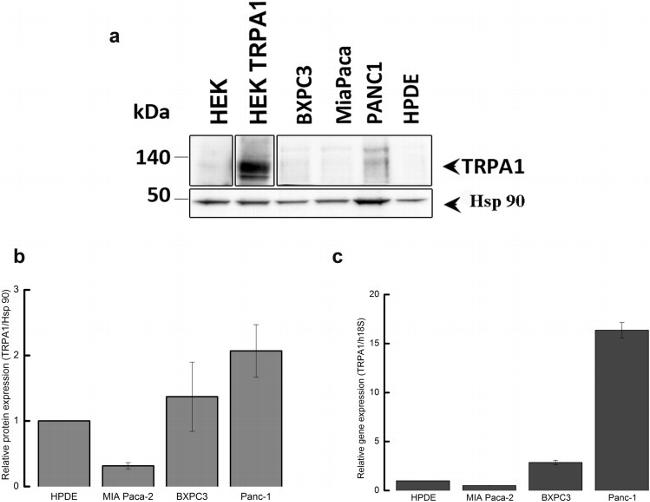 TRPA1 Antibody in Western Blot (WB)