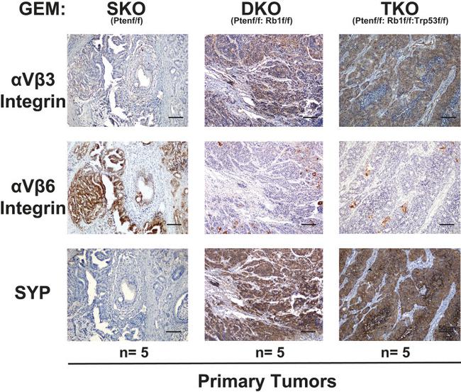 Synaptophysin Antibody in Immunohistochemistry (IHC)