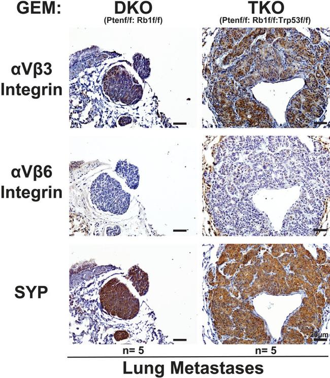 Synaptophysin Antibody in Immunohistochemistry (IHC)