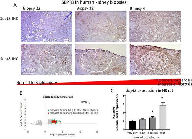 Septin-8 Antibody in Immunohistochemistry (IHC)