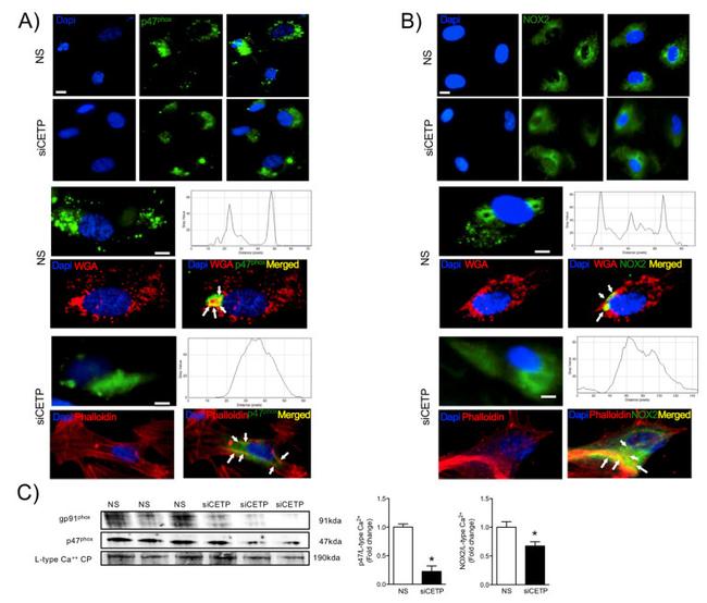 p47phox Antibody in Western Blot, Immunocytochemistry (WB, ICC/IF)