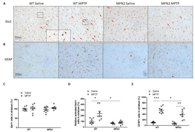 GFAP Antibody in Immunohistochemistry (IHC)