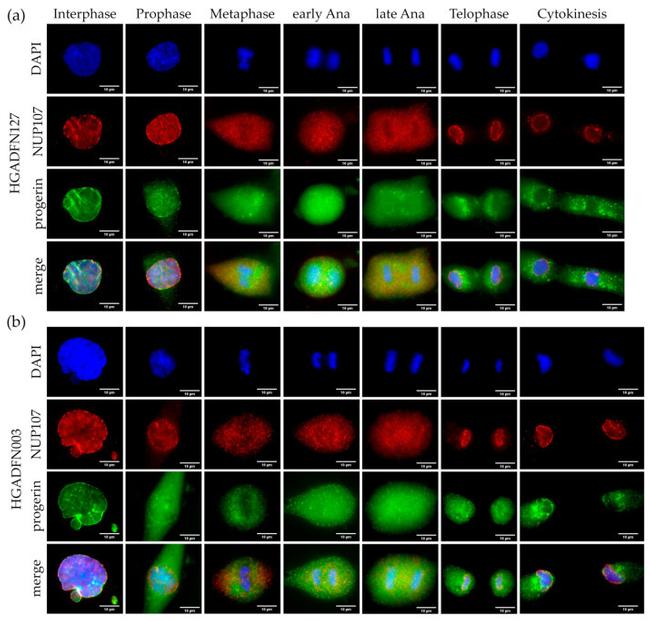 NUP107 Antibody in Immunocytochemistry (ICC/IF)